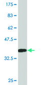 Monoclonal Anti-S100A7 antibody produced in mouse clone 1F8, purified immunoglobulin, buffered aqueous solution