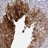 Anti-COX2 antibody produced in rabbit Prestige Antibodies&#174; Powered by Atlas Antibodies, affinity isolated antibody, buffered aqueous glycerol solution
