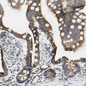 Anti-CLPP antibody produced in rabbit Prestige Antibodies&#174; Powered by Atlas Antibodies, affinity isolated antibody, buffered aqueous glycerol solution