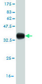 Monoclonal Anti-AURKB antibody produced in mouse clone 6H7, purified immunoglobulin, buffered aqueous solution