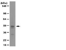 Anti-beta Arrestin 1 Antibody, clone 3H11.2 clone 3H11.2, from mouse
