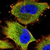 Anti-NDUFAF1 antibody produced in rabbit Prestige Antibodies&#174; Powered by Atlas Antibodies, affinity isolated antibody, buffered aqueous glycerol solution