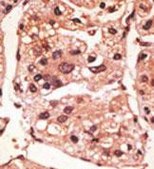 [KO Validated]Anti-Presenilin 1 antibody produced in rabbit [Knockout Validated],purified polyclonal antibody, buffered aqueous solution