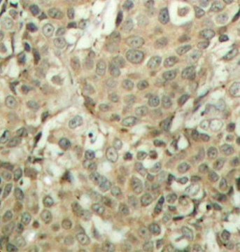 Anti-Phospho-CFL1-S3 antibody produced in rabbit
