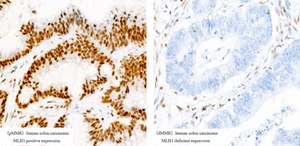 [KO Validated]Anti-MLH1 Antibody, clone 8K1T2, Rabbit Monoclonal