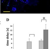 Anti-Actin, &#945;-Smooth Muscle - Cy3&#8482; antibody, Mouse monoclonal clone 1A4, purified from hybridoma cell culture