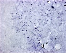 Anti-Calcitonin Gene Related Peptide antibody produced in rabbit whole antiserum