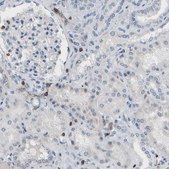 Anti-EVL antibody produced in rabbit Prestige Antibodies&#174; Powered by Atlas Antibodies, affinity isolated antibody, buffered aqueous glycerol solution