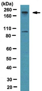 Anti-BAF180 Antibody from rabbit