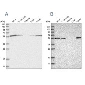 Anti-DBNL antibody produced in rabbit Prestige Antibodies&#174; Powered by Atlas Antibodies, affinity isolated antibody, buffered aqueous glycerol solution