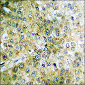 Anti-phospho-Tau (pSer396) antibody produced in rabbit affinity isolated antibody