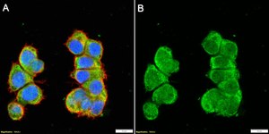 Anti-ATXN2 Antibody, clone 3N14 ZooMAb&#174; Rabbit Monoclonal recombinant, expressed in HEK 293 cells