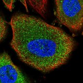 Anti-PYGB antibody produced in rabbit Prestige Antibodies&#174; Powered by Atlas Antibodies, affinity isolated antibody, buffered aqueous glycerol solution