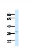 Anti-SDHB antibody produced in rabbit affinity isolated antibody