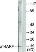 Anti-p14 ARF antibody produced in rabbit affinity isolated antibody