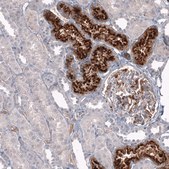 Monoclonal Anti-CHI3L1 antibody produced in mouse Prestige Antibodies® Powered by Atlas Antibodies, clone CL12314, purified immunoglobulin, buffered aqueous glycerol solution