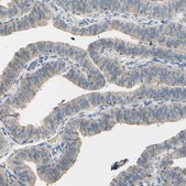 Anti-CDH6 antibody produced in rabbit Ab2, Prestige Antibodies&#174; Powered by Atlas Antibodies, affinity isolated antibody, buffered aqueous glycerol solution