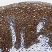 Anti-TRIM29 antibody produced in rabbit Prestige Antibodies&#174; Powered by Atlas Antibodies, affinity isolated antibody, buffered aqueous glycerol solution