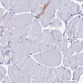 Anti-FTL antibody produced in rabbit Prestige Antibodies&#174; Powered by Atlas Antibodies, affinity isolated antibody, buffered aqueous glycerol solution