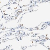 Anti-ARPC1B antibody produced in rabbit Prestige Antibodies&#174; Powered by Atlas Antibodies, affinity isolated antibody, buffered aqueous glycerol solution