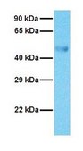 Anti-CYP2E1 affinity isolated antibody