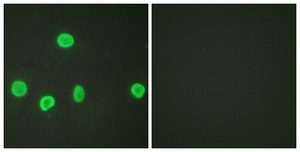 Anti-Histone H3 (Acetyl-Lys18) antibody produced in rabbit affinity isolated antibody