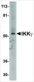 Anti-IKK&#947; antibody produced in rabbit affinity isolated antibody, buffered aqueous solution