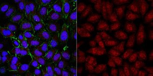 Anti-TERT Antibody from rabbit, purified by affinity chromatography