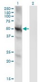 Monoclonal Anti-PPP3CC antibody produced in mouse clone 4D1, purified immunoglobulin, buffered aqueous solution