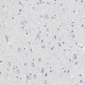 Anti-GZMM antibody produced in rabbit Prestige Antibodies&#174; Powered by Atlas Antibodies, affinity isolated antibody, buffered aqueous glycerol solution