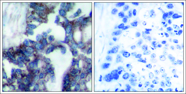 Anti-RPS6KB1 (Ab-424) antibody produced in rabbit affinity isolated antibody