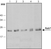 Anti-Rab7 antibody, Mouse monoclonal ~2&#160;mg/mL, clone Rab7-117, purified from hybridoma cell culture