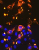 Anti-GLUT2/SLC2A2 antibody produced in rabbit