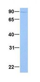Anti-AP1G1 antibody produced in rabbit affinity isolated antibody