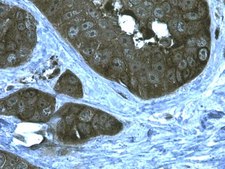 Anti-Heat Shock Protein 90&#945; Antibody from rabbit