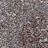 Anti-FEN1 antibody produced in rabbit Prestige Antibodies&#174; Powered by Atlas Antibodies, affinity isolated antibody, buffered aqueous glycerol solution