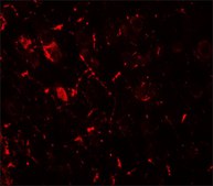 Anti-ULK1 antibody produced in rabbit affinity isolated antibody