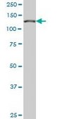 Monoclonal Anti-CAND1 antibody produced in mouse clone 5F2, purified immunoglobulin, buffered aqueous solution