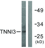Anti-TNNI3 antibody produced in rabbit affinity isolated antibody