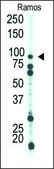 Anti-PFKP (C-term) antibody produced in rabbit IgG fraction of antiserum, buffered aqueous solution