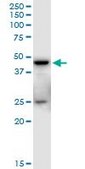 Anti-SHARPIN antibody produced in mouse purified immunoglobulin, buffered aqueous solution