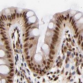 Anti-MED12 antibody produced in rabbit Ab1, Prestige Antibodies&#174; Powered by Atlas Antibodies, affinity isolated antibody, buffered aqueous glycerol solution