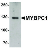 Anti-MYBPC1 antibody produced in rabbit affinity isolated antibody