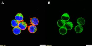 Anti-STAT2 Antibody, clone 1F7 ZooMAb&#174; Rabbit Monoclonal recombinant, expressed in HEK 293 cells