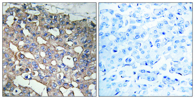 Anti-STMN1 antibody produced in rabbit affinity isolated antibody