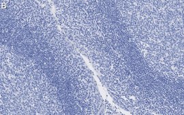 Anti-β-Tubulin Antibody, clone 1C9 ZooMAb® Rabbit Monoclonal recombinant, expressed in HEK 293 cells