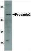 Anti-PROSAPIP2 antibody produced in rabbit affinity isolated antibody, buffered aqueous solution