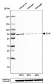 Anti-ESR1 antibody produced in rabbit Prestige Antibodies&#174; Powered by Atlas Antibodies, affinity isolated antibody, buffered aqueous glycerol solution