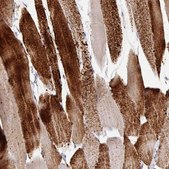 Anti-PYGM antibody produced in rabbit Prestige Antibodies&#174; Powered by Atlas Antibodies, affinity isolated antibody, buffered aqueous glycerol solution