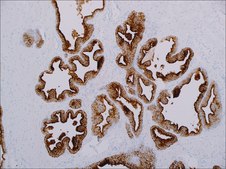 PSMA (EP192) Rabbit Monoclonal Primary Antibody